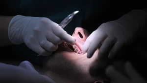 Dentysta; zdj. ilustracyjne