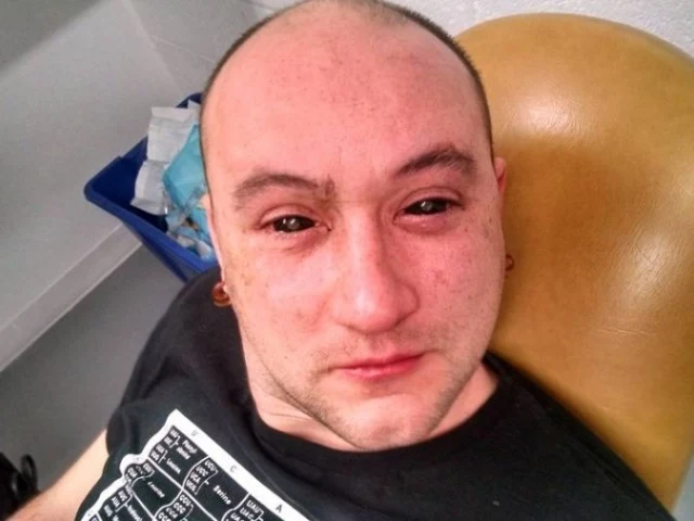 Gabriel Licina, naukowiec, który poddał się zabiegowi wstrzyknięci do oczu Chlorinu e6