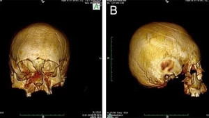Odkryto zdeformowane czaszki w Chorwacji - do kogo należały?