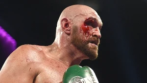 Tyson Fury