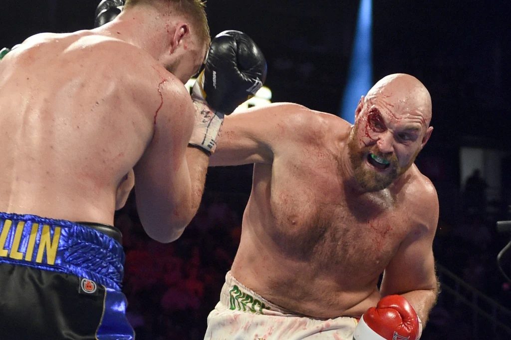 Tyson Fury w pojedynku z Otto Wallinem Tyson Fury w pojedynku z Otto Wallinem