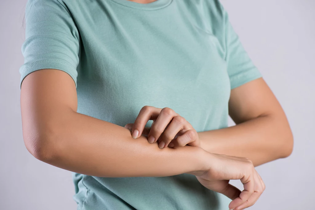 Długotrwałe swędzenie Jeśli często odczuwasz swędzenie skóry w różnych partiach ciała, którego nie potrafi wyjaśnić ani twój internista, ani dermatolog, skonsultuj się z onkologiem. Swędzenie to bardzo niespecyficzny objaw, który rzadko kojarzymy z nowotworem, zdarza się więc, że minie wiele lat, zanim lekarzom uda się postawić właściwą diagnozę. Długotrwałe swędzenie Jeśli często odczuwasz swędzenie skóry w różnych partiach ciała, którego nie potrafi wyjaśnić ani twój internista, ani dermatolog, skonsultuj się z onkologiem. Swędzenie to bardzo niespecyficzny objaw, który rzadko kojarzymy z nowotworem, zdarza się więc, że minie wiele lat, zanim lekarzom uda się postawić właściwą diagnozę.