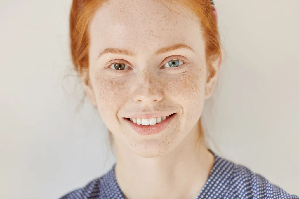 Każde oko inne Szacuje się, że 1 proc. populacji jest dotknięta heterochromią. To nic innego, jak sytuacja, w której każde oko ma inny kolor. Heterochromia jest uznawania za wadę genetyczną i nie ma zazwyczaj wpływu na życie, choć stanowi ciekawy akcent urodowy. Każde oko inne Szacuje się, że 1 proc. populacji jest dotknięta heterochromią. To nic innego, jak sytuacja, w której każde oko ma inny kolor. Heterochromia jest uznawania za wadę genetyczną i nie ma zazwyczaj wpływu na życie, choć stanowi ciekawy akcent urodowy.