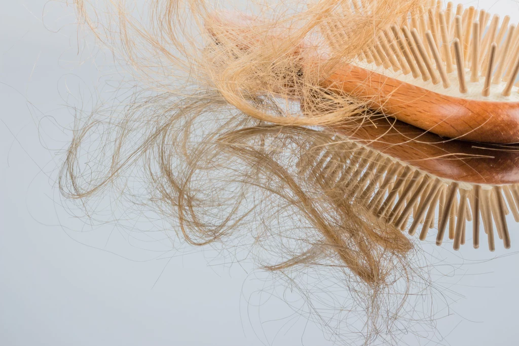 Wypadanie włosów może być jednym z objawów poważnej choroby