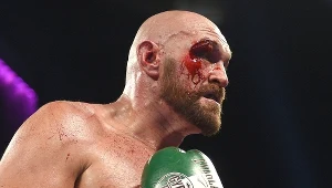 Tyson Fury