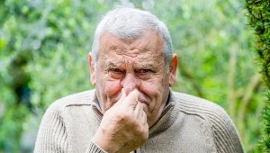 Guzowatość nosa to problem wielu mężczyzn. Szpecącą skórę da się wyleczyć