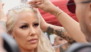 Amber Rose poddała się kolejnym zabiegom upiększającym