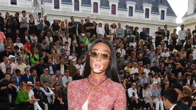 Bielactwo, bo na tę chorobę cierpi Winnie Harlow, stało się znakiem rozpoznawczym 
modelki.