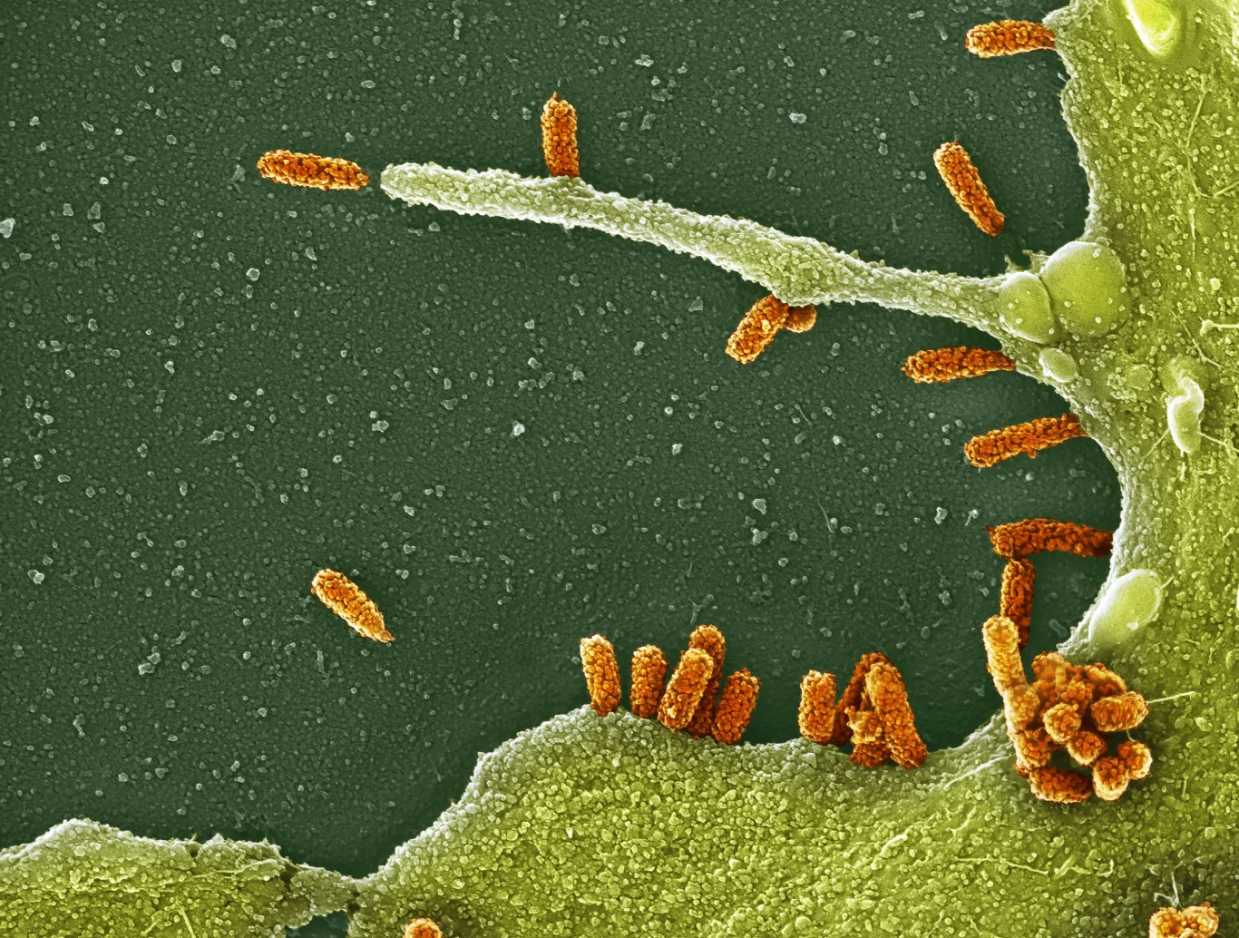 H1N1 - podtyp wirusa grypy typu A pod mikroskopem H1N1 - podtyp wirusa grypy typu A pod mikroskopem