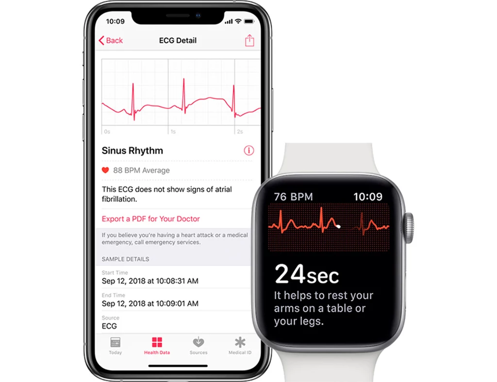 Apple Watch i funkcja EKG