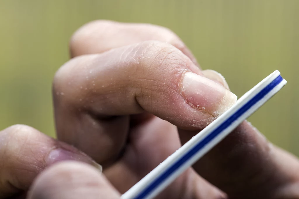 Zniszczone paznokcie są często efektem prac domowych