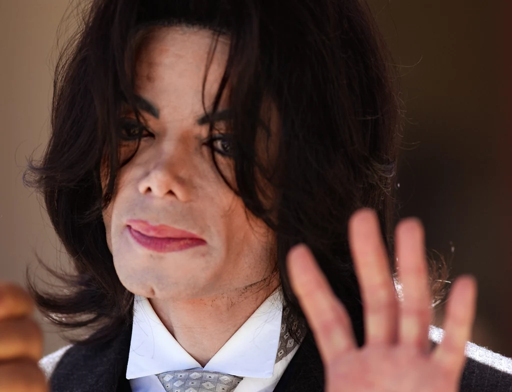 Michael Jackson po wypadku w 1984 roku nie był tym samym człowiekiem