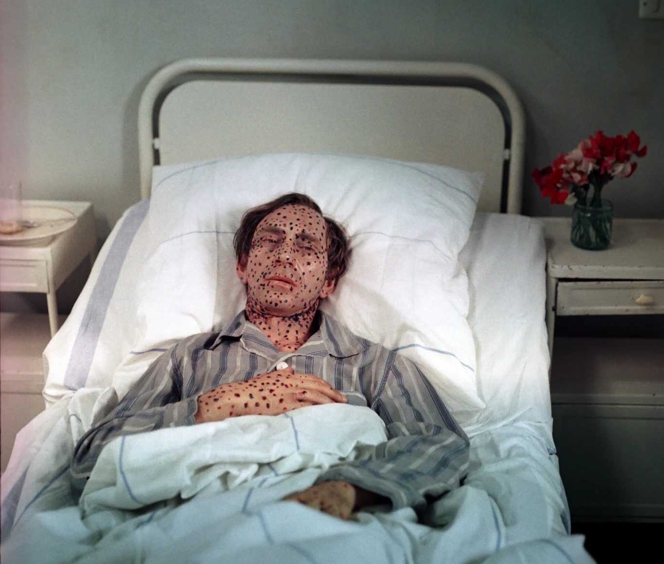 "Zaraza"
Polacy nie gęsi, swoje filmy o epidemiach mają. Wyreżyserowana przez Romana Załuskiego "Zaraza", opowiada inspirowaną prawdziwymi wydarzeniami historię epidemii czarnej ospy. W jej centrum jest pracujący w Sanepidzie lekarz Adam Rawicz (w tej roli Tadeusz Borowski), który jako pierwszy rozpoznaje chorobę. Rawicz rozpoczyna pracę nad wynalezieniem skutecznego lekarstwa. Tymczasem we Wrocławiu zaczynają mnożyć się przypadki śmiertelne.
(PAP Life)