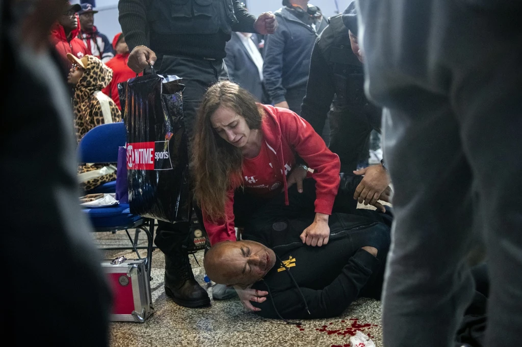 Trener James Ali Bashir tuż po brutalnym ataku Trener James Ali Bashir tuż po brutalnym ataku
