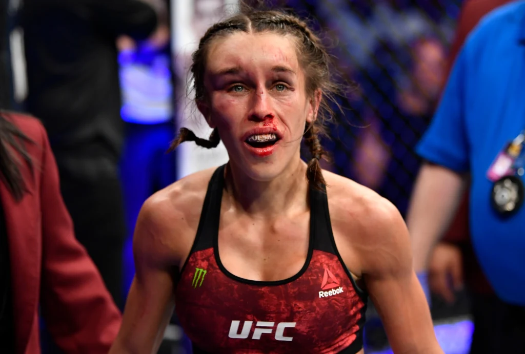 Joanna Jędrzejczyk Joanna Jędrzejczyk
