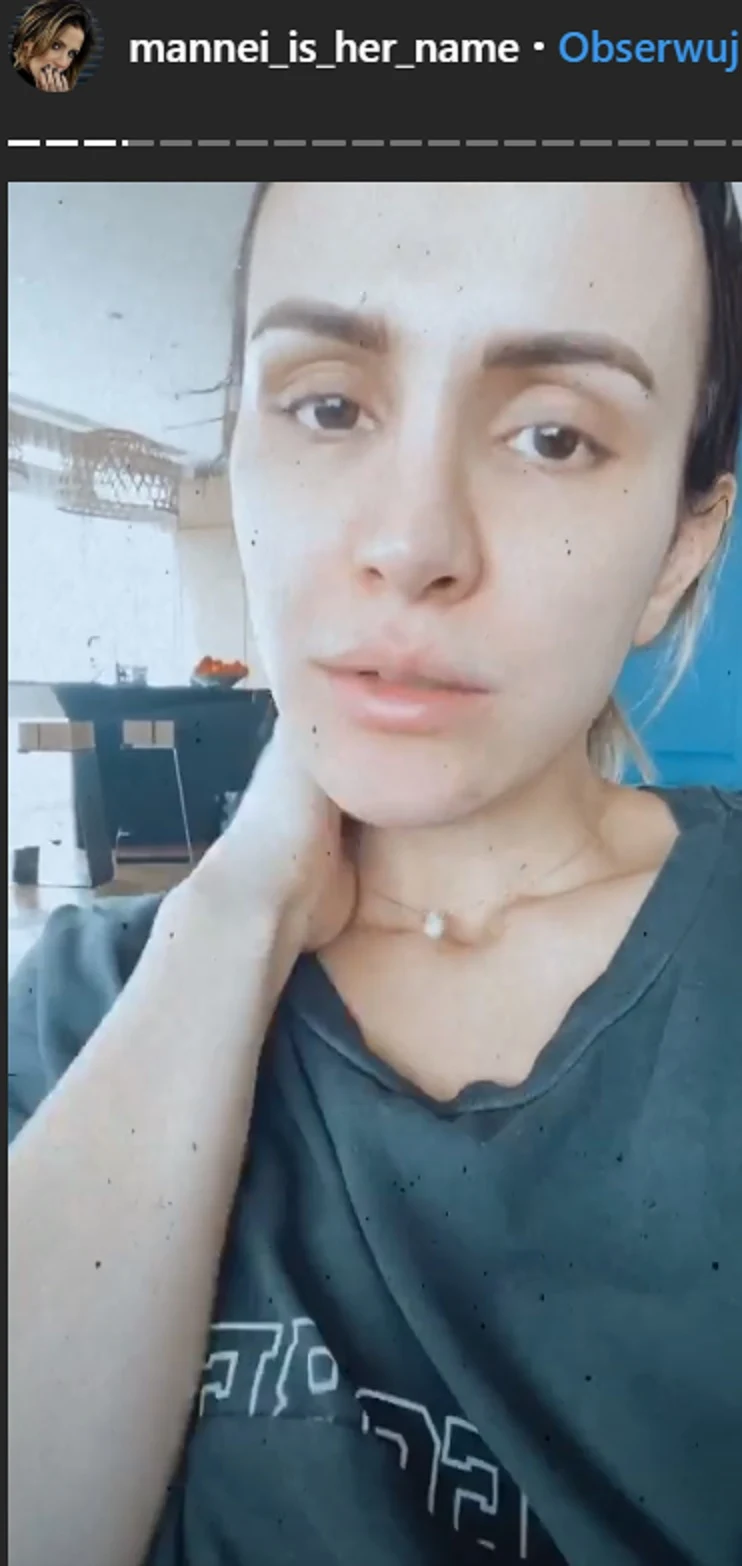 Sara Boruc opowiedziała o swojej chorobie na InstaStories Sara Boruc opowiedziała o swojej chorobie na InstaStories