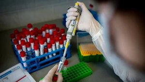 Ponowne badania pacjentki dały wynik ujemny 