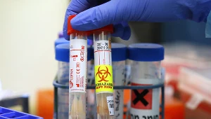 Wątpliwości ws. pochodzenia koronawirusa