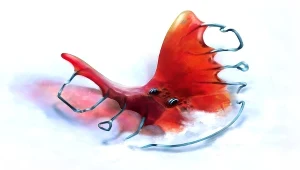 The Suicide of Rachel Foster