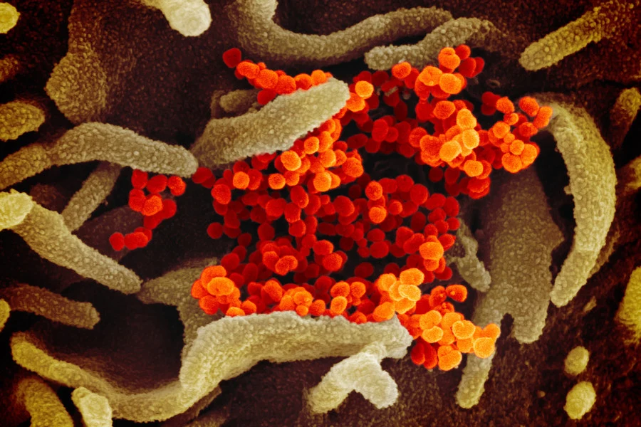 SARS-CoV-2 SARS-CoV-2