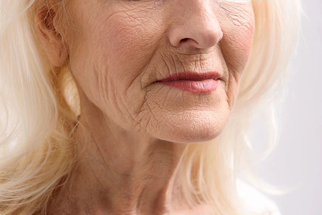 Zmarszczki są jedną z głównych oznak starzenia się skóry