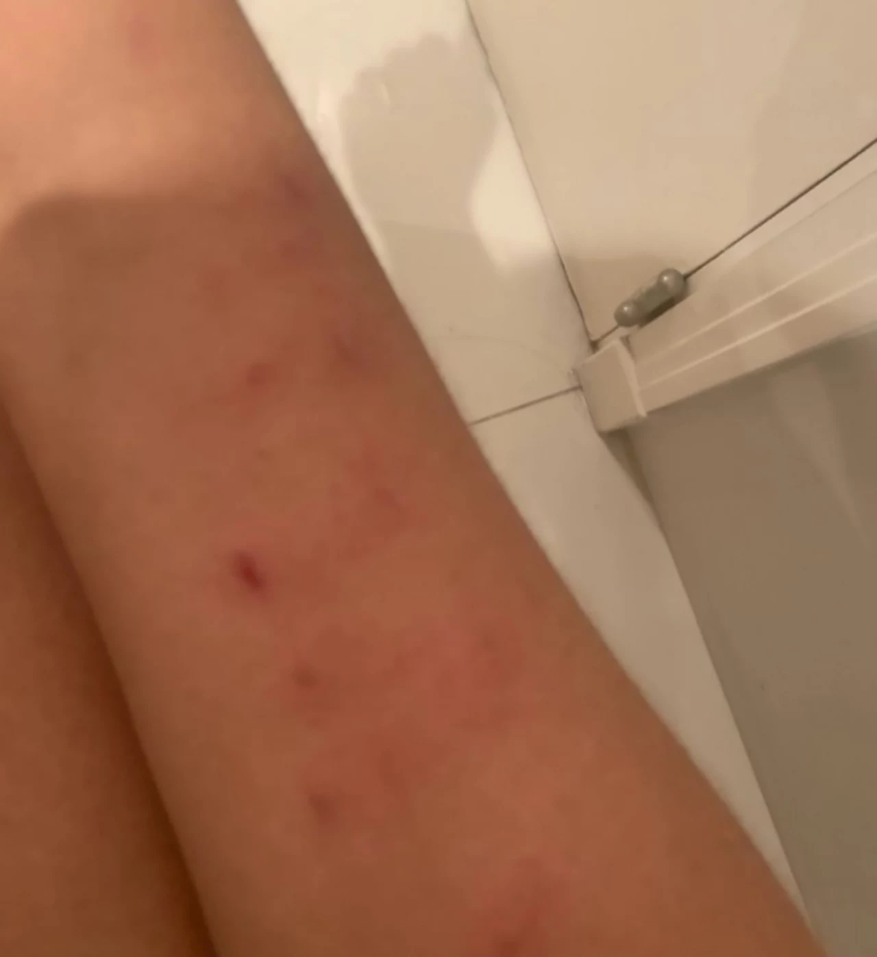 Na zdjęciu: brutalnie pobita Daniela Cortes