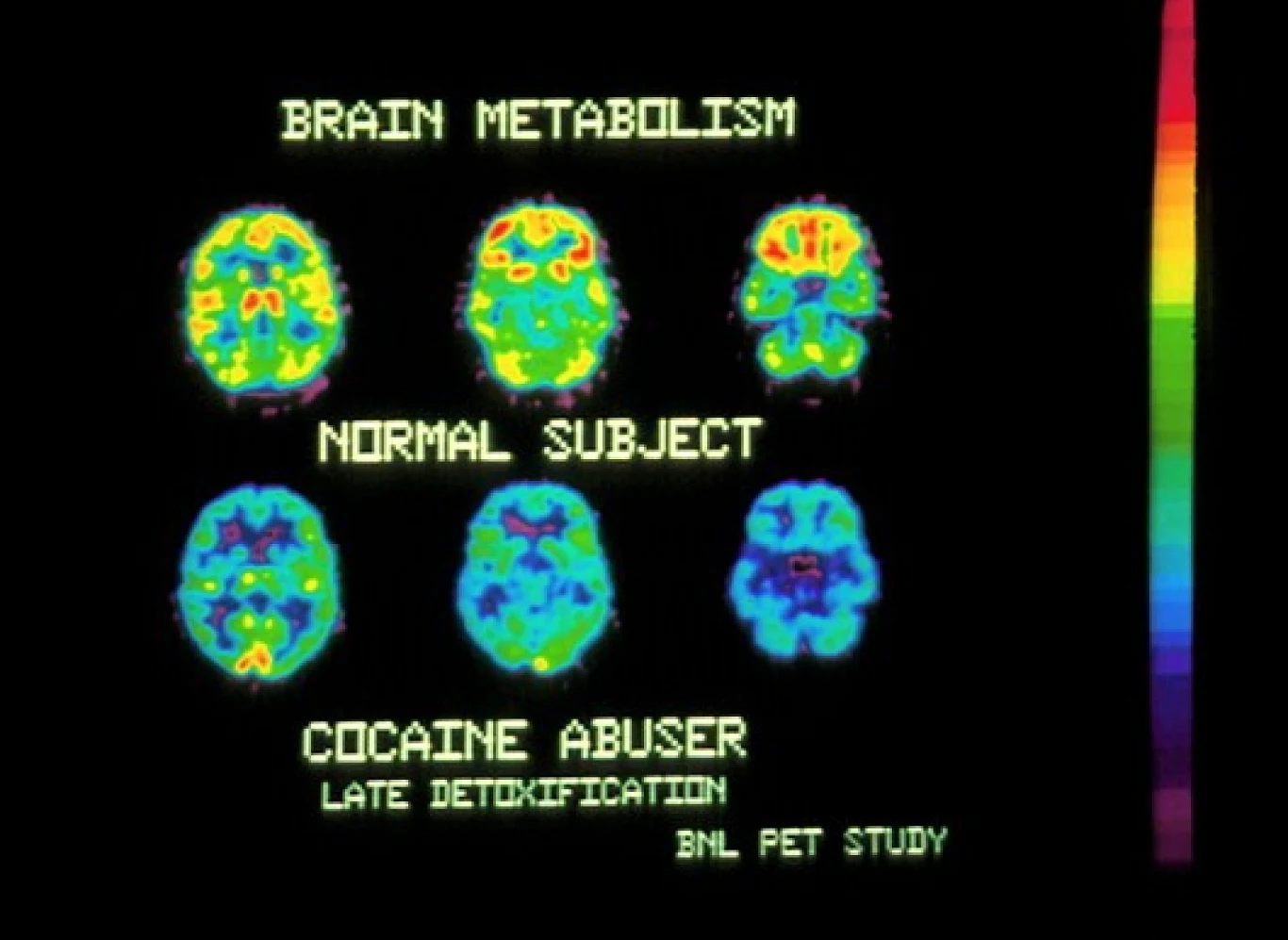 Efekt zjedzenia soli naukowcy porównują do stanu po zażyciu... kokainy Efekt zjedzenia soli naukowcy porównują do stanu po zażyciu... kokainy