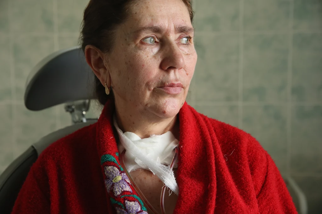 Sposoby leczenia Terapia guza tarczycy zależy od charakteru samej zmiany. Jeśli jest łagodna, proponuje się przyjmowanie leków, które hamują wydzielanie hormonów tarczycy. Usunięcie operacyjne dotyczy tylko guzów dużych rozmiarów zagrażających życiu pacjenta. Złośliwe odmiany guzów nie zawsze muszą oznaczać nowotwór. Warto jednak wiedzieć, jakie typy nowotworów mogą zaatakować tarczycę. Jest to: Rak brodawkowaty – to najczęstszy i jednocześnie najlepiej rokujący nowotwór tarczycy Rak pęcherzykowy – wykrywany u osób między czterdziestym a pięćdziesiątym rokiem życia. Daje przerzuty do płuc i kości. Rak rdzeniasty - pojawia się u osób starszych, po pięćdziesiątym rokiem życia. Rak anaplastyczny – jest najbardziej złośliwym typem nowotworu tarczycy i charakteryzuje się bardzo szybkim rozwojem. Sposoby leczenia Terapia guza tarczycy zależy od charakteru samej zmiany. Jeśli jest łagodna, proponuje się przyjmowanie leków, które hamują wydzielanie hormonów tarczycy. Usunięcie operacyjne dotyczy tylko guzów dużych rozmiarów zagrażających życiu pacjenta. Złośliwe odmiany guzów nie zawsze muszą oznaczać nowotwór. Warto jednak wiedzieć, jakie typy nowotworów mogą zaatakować tarczycę. Jest to: Rak brodawkowaty – to najczęstszy i jednocześnie najlepiej rokujący nowotwór tarczycy Rak pęcherzykowy – wykrywany u osób między czterdziestym a pięćdziesiątym rokiem życia. Daje przerzuty do płuc i kości. Rak rdzeniasty - pojawia się u osób starszych, po pięćdziesiątym rokiem życia. Rak anaplastyczny – jest najbardziej złośliwym typem nowotworu tarczycy i charakteryzuje się bardzo szybkim rozwojem.