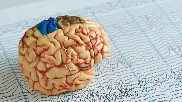 Korzystnie wpływa na mózg? 

Tak. Zawiera polifenole, które poprawiają pamięć. Dotlenia mózg i pomaga chronić go przed chorobami degeneracyjnymi jak parkinson czy alzheimer.

Źródło: Twoje Imperium