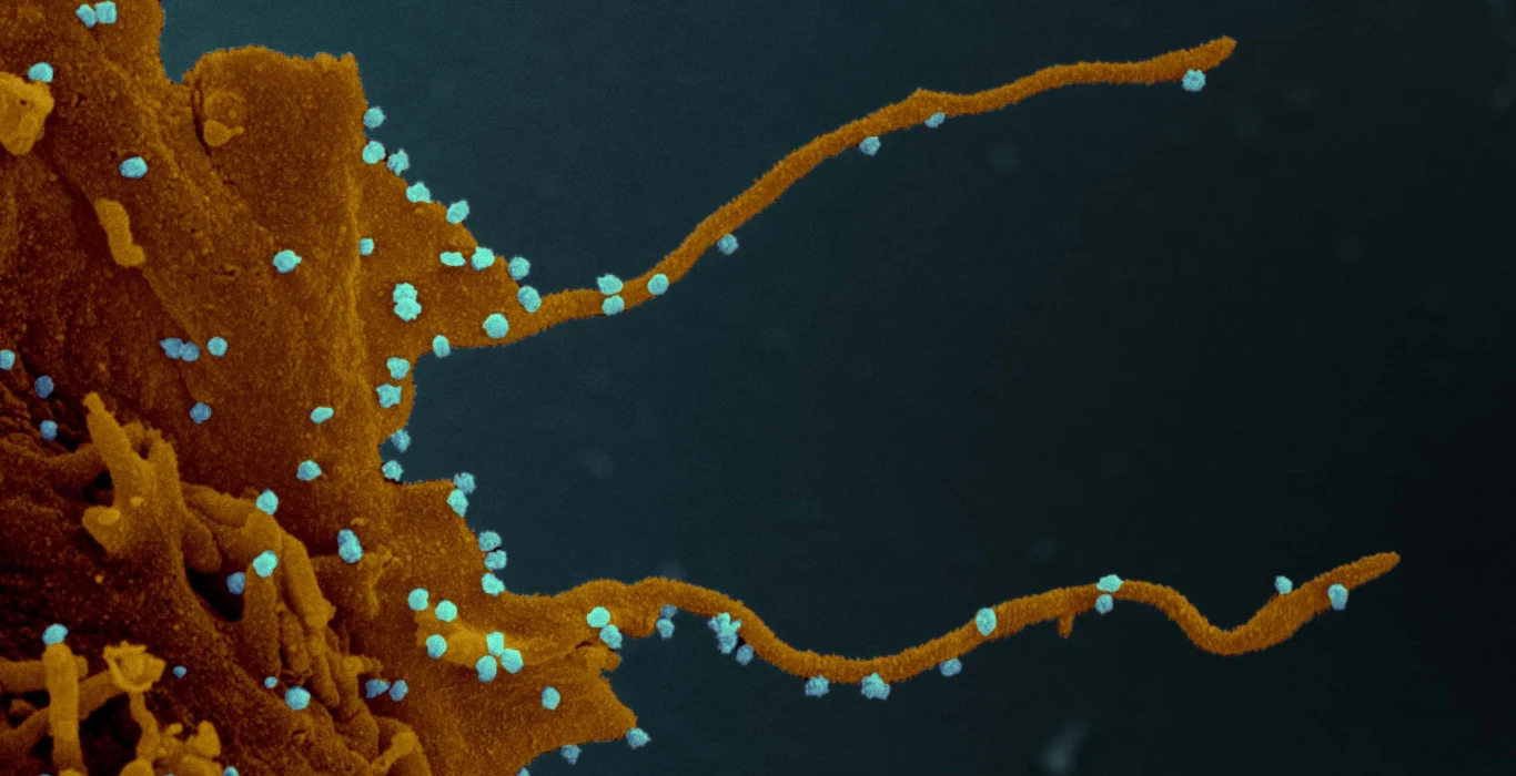 Wirusy SARS-CoV-2 na komórce z filopodiami Wirusy SARS-CoV-2 na komórce z filopodiami