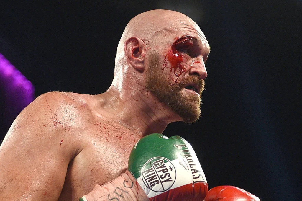 Tyson Fury Tyson Fury