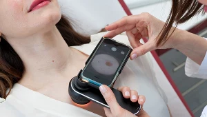 Należy unikać  przebywania na bardzo intensywnym słońcu, szczególnie w godzinach 11.00-16.00