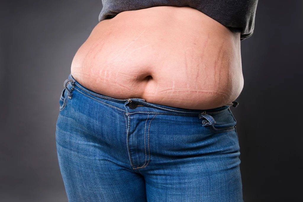 Poważna otyłość brzuszna może być szkodliwa nie tylko dla zdrowia, ale i życia