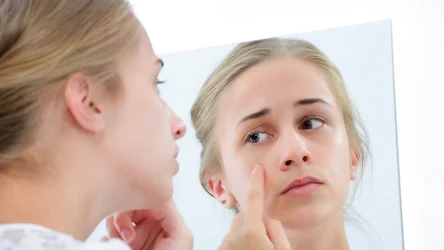 Jak skutecznie pozbyć się wągrów?