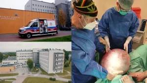 Przyszła do lekarza, aby sprawdził, czy nie jest w ciąży. Nie była, miała 20-kilogramowego guza  (fot. Powiat Oświęcimski/ZOZ Oświęcim)