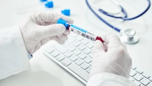 W Czechach robi się cztery razy więcej testów niż w Polsce"