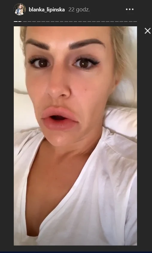 Blanka Lipińska zabrała głos na Instagramie Blanka Lipińska zabrała głos na Instagramie