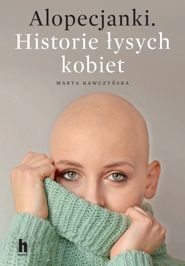 Alopecjanki, Historie łysych kobiet