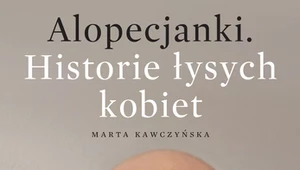 Alopecjanki, Historie łysych kobiet