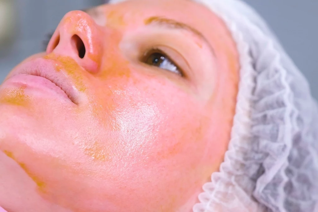 Peeling to coś, co na stałe powinno zagościć w kosmetyczkach nie tylko kobiet, ale również mężczyzn. Jeżeli twoja skóra łatwo ulega podrażnieniom lub gdy widać na niej zmiany zapalne, wybierz peeling enzymatyczny. W przypadku cery mieszanej dobrze jest używać zarówno ziarnistych, jak i tych łagodniejszych. Peeling możesz przygotować samodzielnie - z cukru, soli lub kawy. Peeling to coś, co na stałe powinno zagościć w kosmetyczkach nie tylko kobiet, ale również mężczyzn. Jeżeli twoja skóra łatwo ulega podrażnieniom lub gdy widać na niej zmiany zapalne, wybierz peeling enzymatyczny. W przypadku cery mieszanej dobrze jest używać zarówno ziarnistych, jak i tych łagodniejszych. Peeling możesz przygotować samodzielnie - z cukru, soli lub kawy.