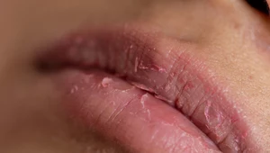 Wyjaśniamy, dlaczego warto regularnie wykonywać peeling ust