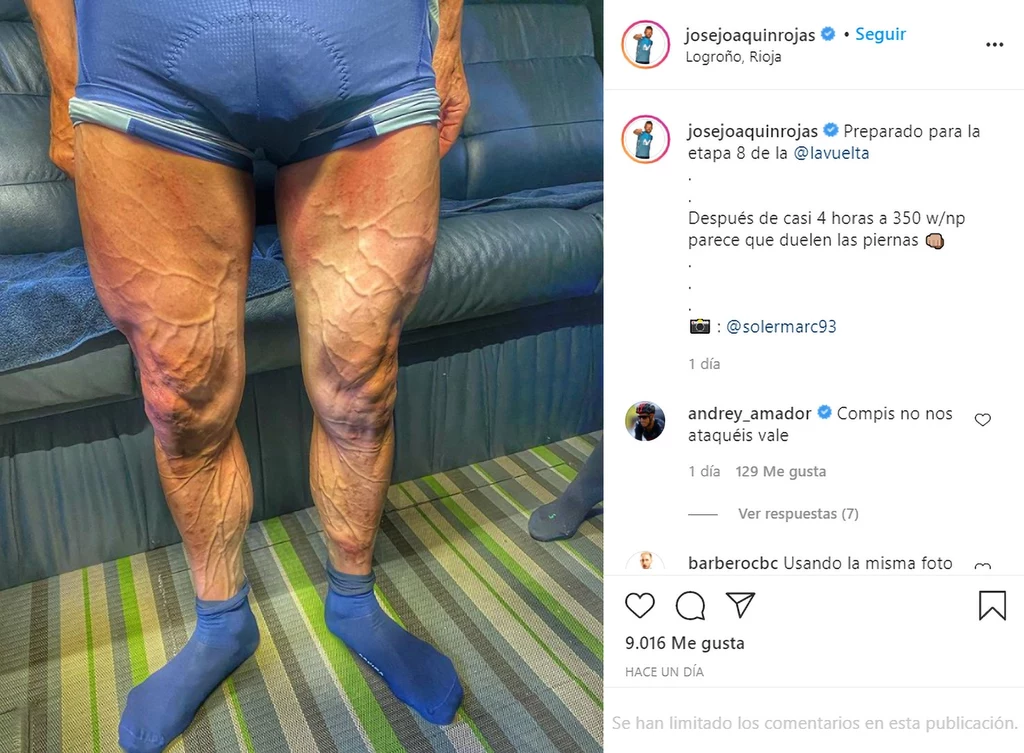José Joaquín Rojas pokazał, jak wyglądają jego nogi po tygodniu wyścigu. Widać na nich każdy mięsień i każdą, nawet najmniejszą żyłkę, niczym w atlasie anatomicznym. Czy was też już od samego patrzenia zaczęły boleć nogi? José Joaquín Rojas pokazał, jak wyglądają jego nogi po tygodniu wyścigu. Widać na nich każdy mięsień i każdą, nawet najmniejszą żyłkę, niczym w atlasie anatomicznym. Czy was też już od samego patrzenia zaczęły boleć nogi?