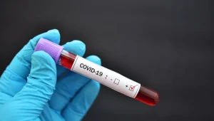 Koronawirus. Pracodawcy są gotowi do testowania pracowników