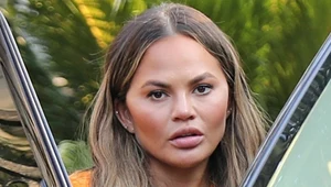 ​Chrissy Teigen wyjawiła sekret swojej nieskazitelnej cery. Jest nim olejek śliwkowy