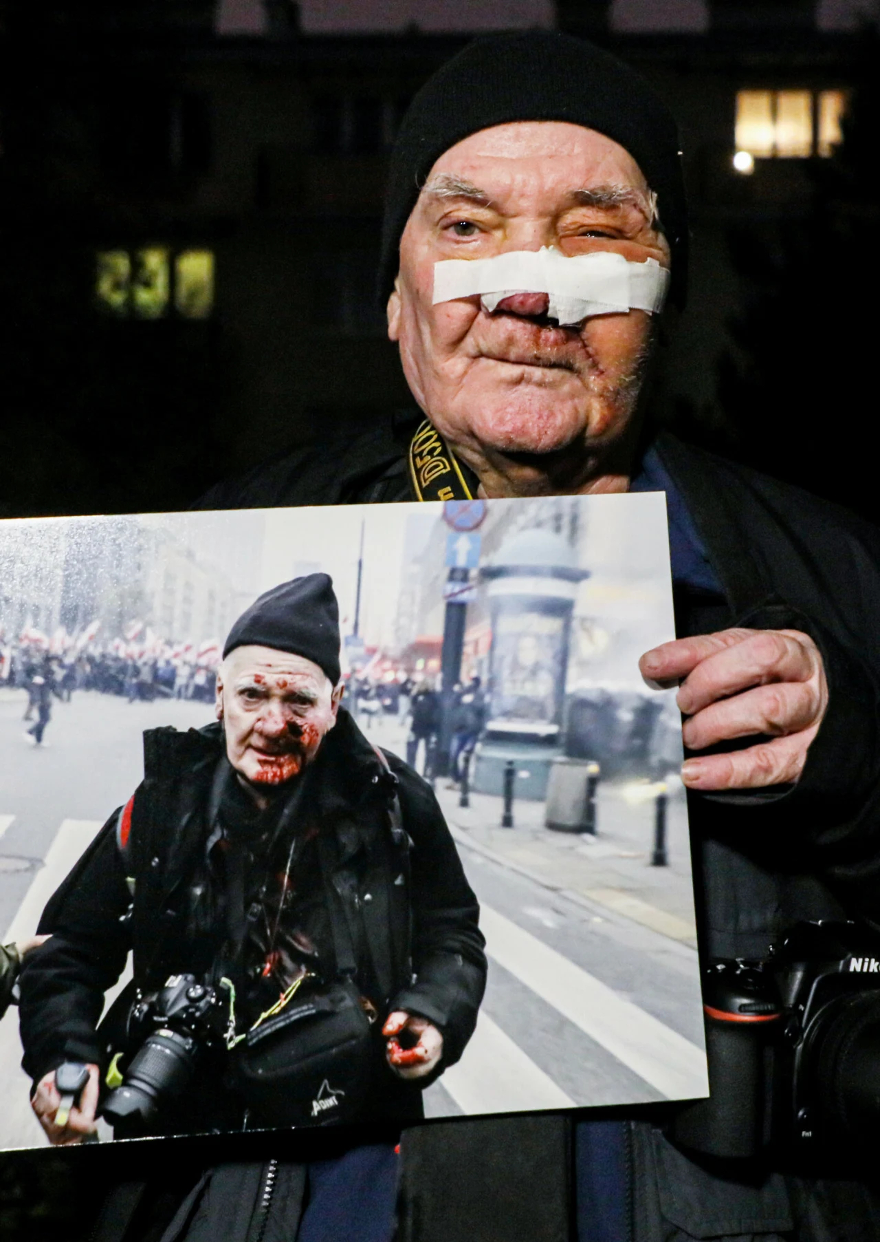 Fotoreporter Tomasz Gutry - postrzelony przez policję podczas Marszu Niepodległości - wyszedł już ze szpitala