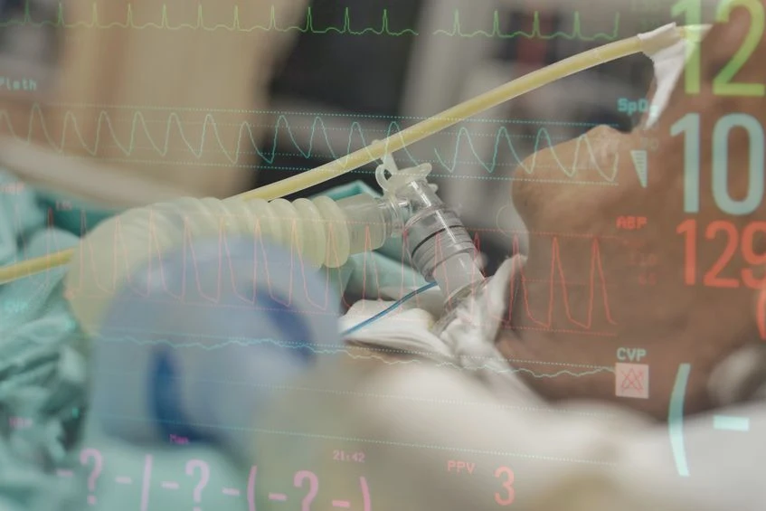 Aby utrzymać oddech pacjenta po krwawieniu śródmózgowym, może być potrzebna tlenoterapia lub podłączenie go do respiratora