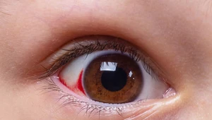 Groźne objawy chorób na oczach 
