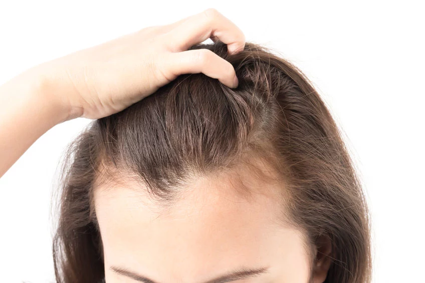 Wypadanie Włosów Przyczyny I Leczenie Kobieta W Interiapl 4145