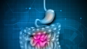 Choroba Leśniowskiego-Crohna. Jak z nią żyć?