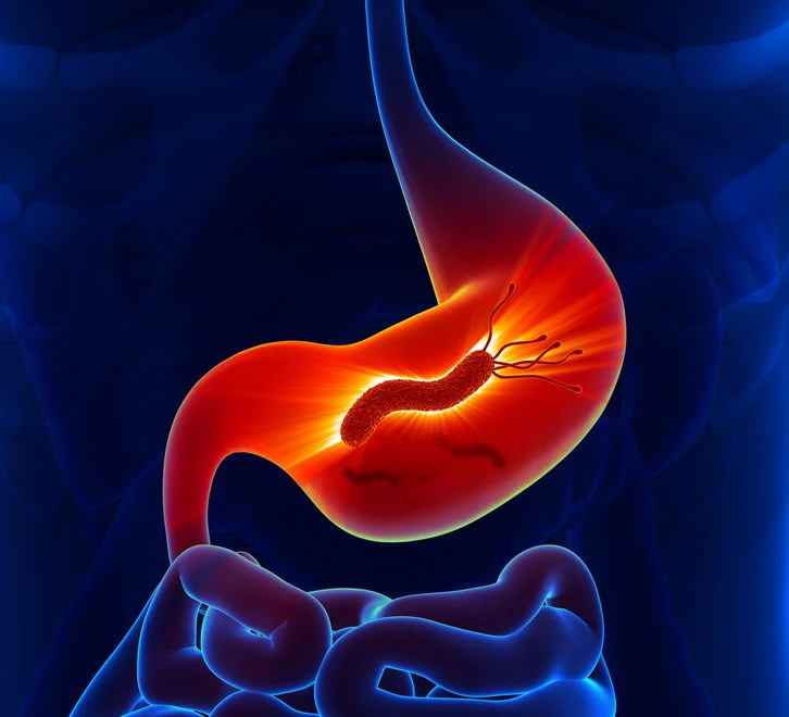 Zakażenie bakterią Helicobacter pylori Zakażenie bakterią Helicobacter pylori